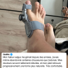 orthèse hallux valgus