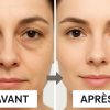comparaison-avant-apr-s-masseur-yeux-6d-subtile.jpg Calmazen Technologie 6D