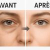 comparaison-avant-apr-s-masseur-yeux-bluetooth.jpg Calmazen et bien-être visuel